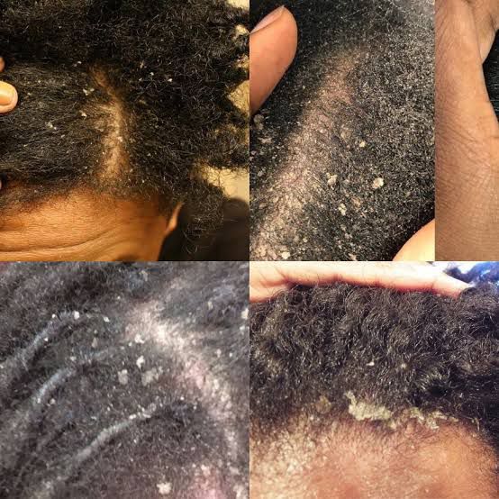CHIREVIVE Hair Revitalizing Conditioner