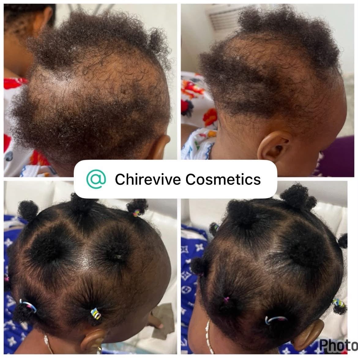 Unretouched CHIREVIVE customer result photo 3
