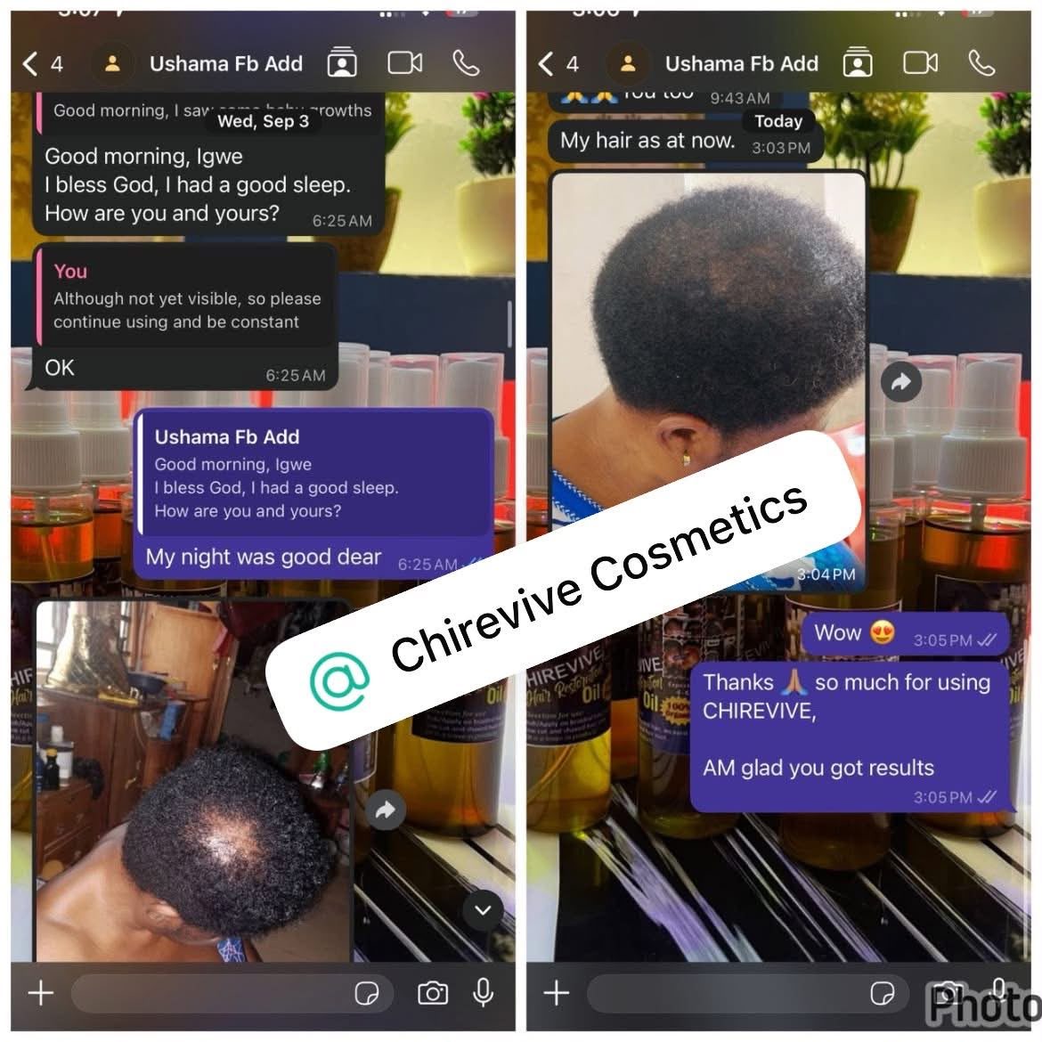 Unretouched CHIREVIVE customer result photo 5